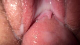 Растрах под микроскопом